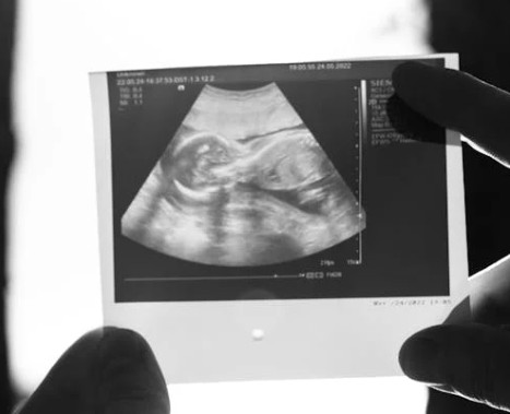 stories/baby-coming_1776093267.jpg