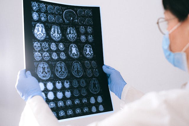 stories/brain-health.jpg