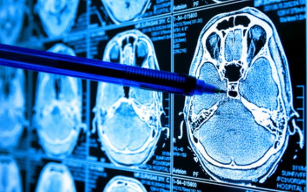 stories/identify-cancer-scans.jpg
